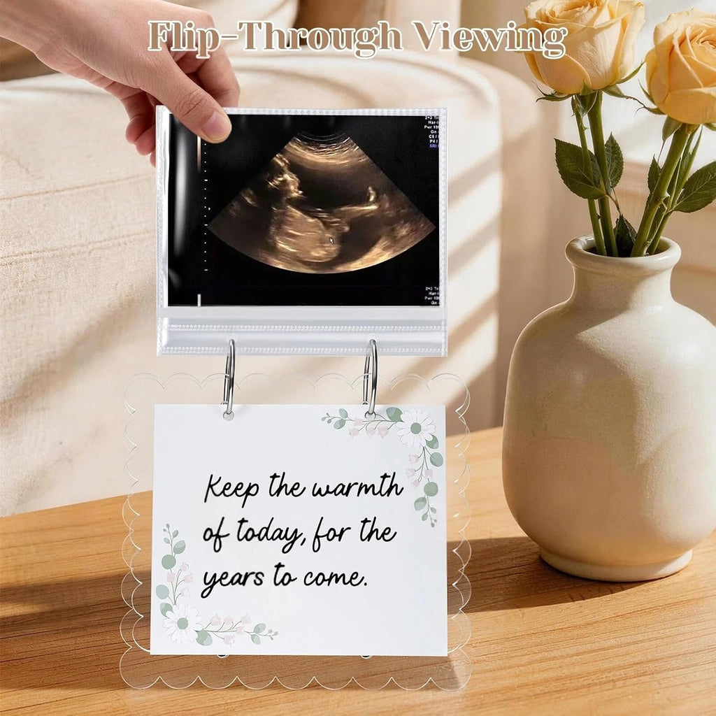 Ultrasound Pregnancy Memory Book, Scalloped Acrylic 3X4 Sonogram Album