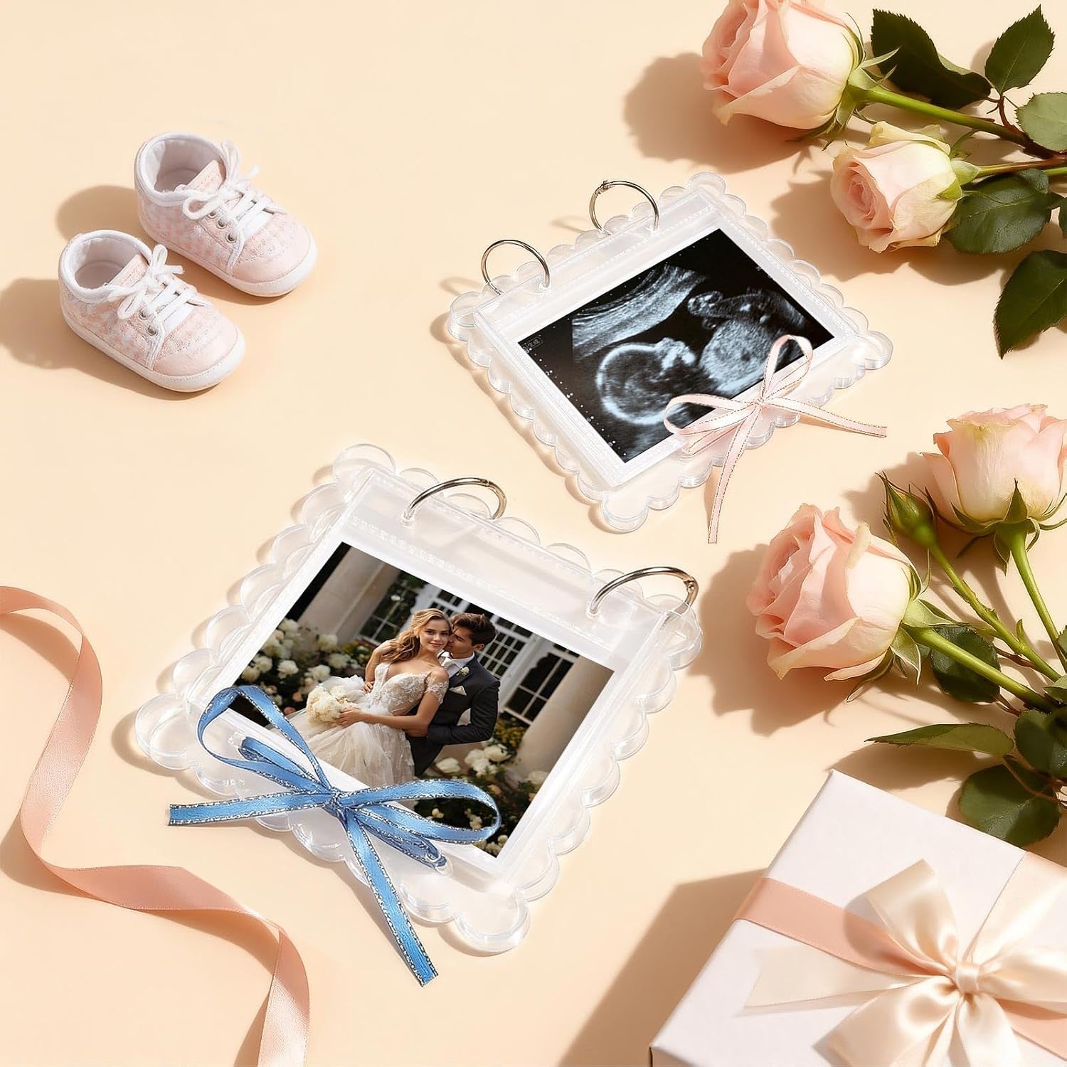 Ultrasound Pregnancy Memory Book, Scalloped Acrylic 3X4 Sonogram Album